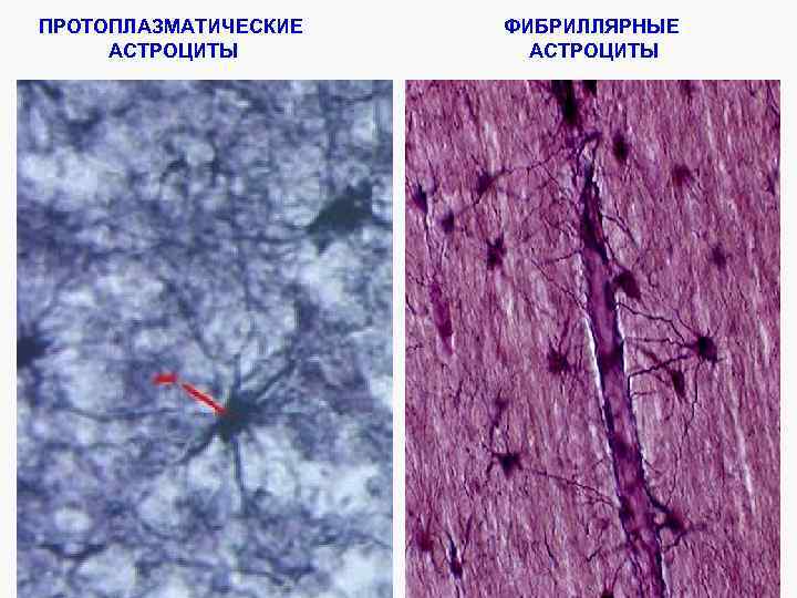 ПРОТОПЛАЗМАТИЧЕСКИЕ АСТРОЦИТЫ ФИБРИЛЛЯРНЫЕ АСТРОЦИТЫ 