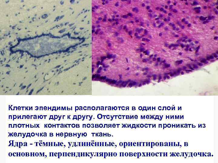 Эпендимная глия Эпендимоциты образуют плотный слой клеток, выстилающих спинномозговой канал и желудочки мозга. Их