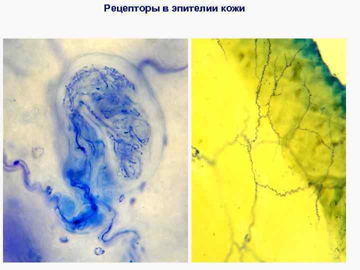 Рецепторы в эпителии кожи 
