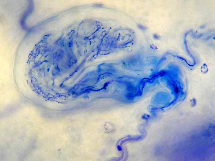 Осязательные (мейснеровы) тельца Располагаются в некоторых сосочках кожи. Тельце включает 3 компонента: окончания дендрита,
