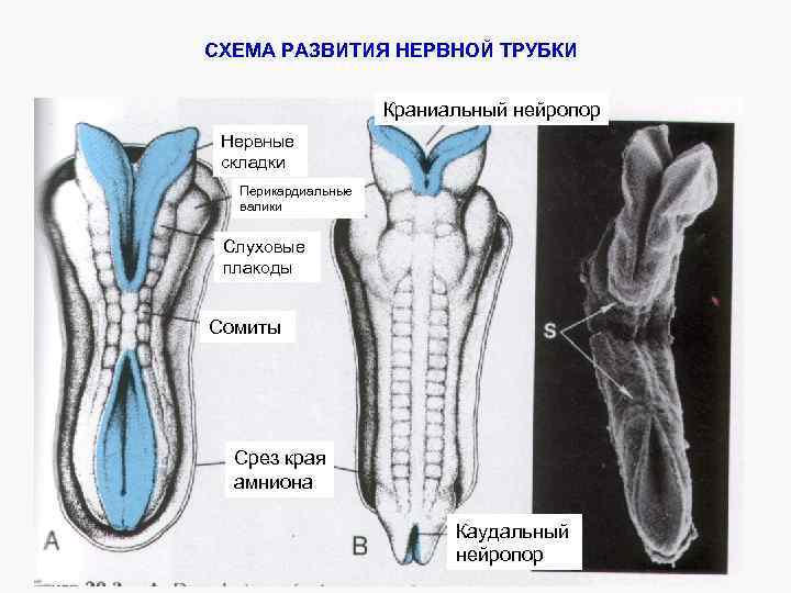 СХЕМА РАЗВИТИЯ НЕРВНОЙ ТРУБКИ Краниальный нейропор Нервные складки Перикардиальные валики Слуховые плакоды Сомиты Срез