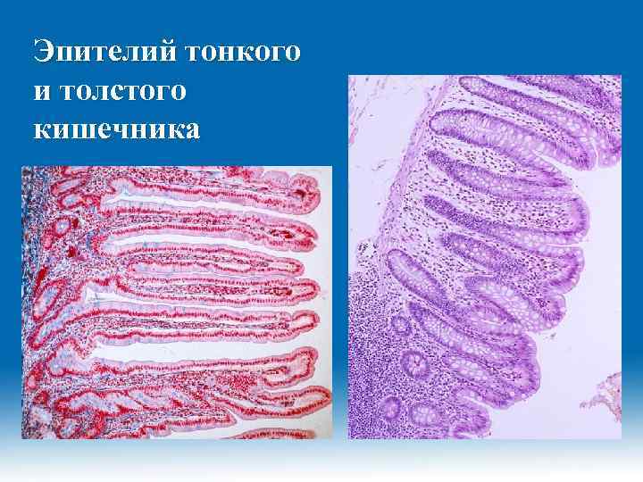 Эпителий тонкого и толстого кишечника 