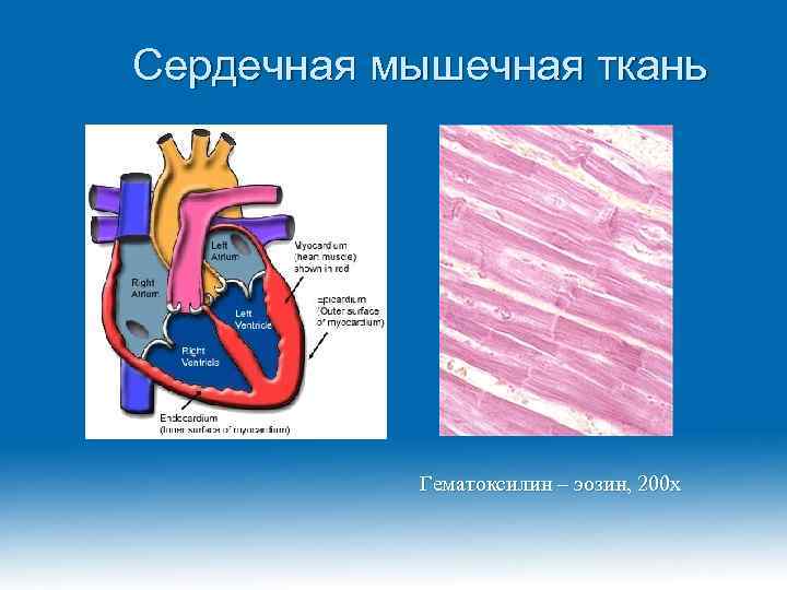 Сердечная мышечная ткань Гематоксилин – эозин, 200 х 