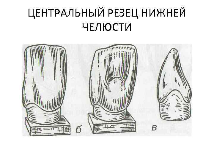 ЦЕНТРАЛЬНЫЙ РЕЗЕЦ НИЖНЕЙ ЧЕЛЮСТИ 