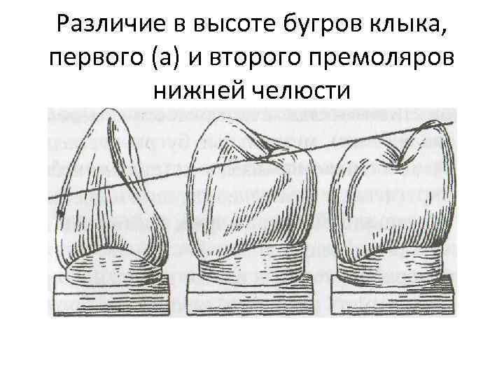 Различие в высоте бугров клыка, первого (а) и второго премоляров нижней челюсти 