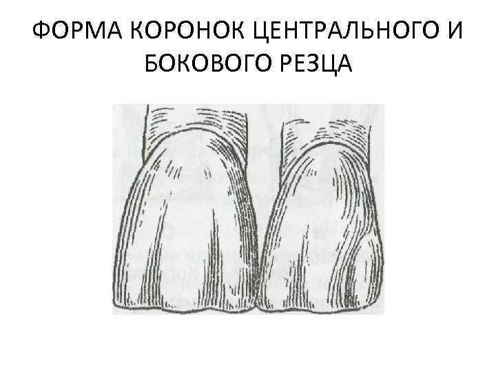 ФОРМА КОРОНОК ЦЕНТРАЛЬНОГО И БОКОВОГО РЕЗЦА 