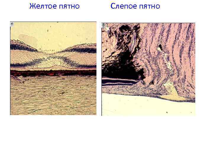 Желтое пятно Слепое пятно 