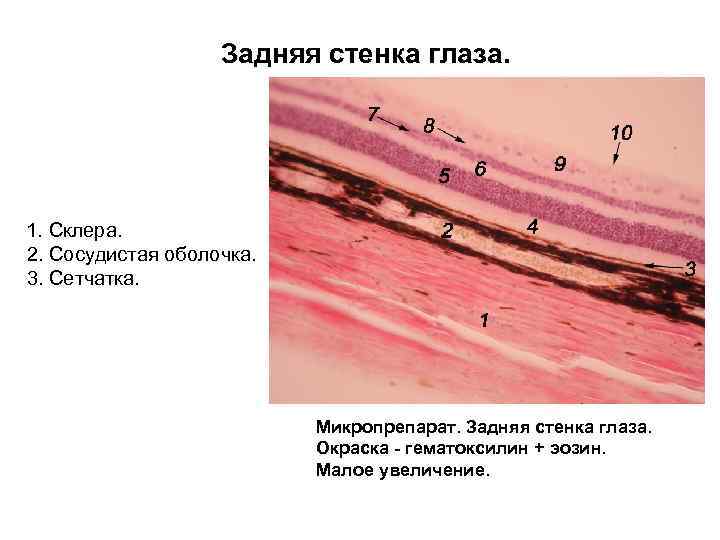 Задняя стенка глаза. 1. Склера. 2. Сосудистая оболочка. 3. Сетчатка. Микропрепарат. Задняя стенка глаза.