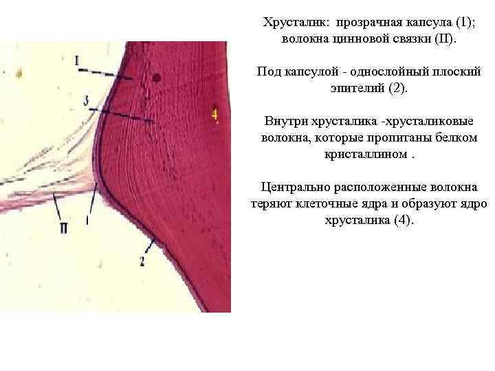 Хрусталик гематоксилин-эозин Хрусталик: прозрачная капсула (1); волокна цинновой связки (II). Под капсулой - однослойный