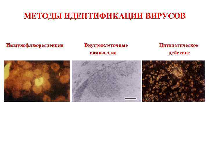 МЕТОДЫ ИДЕНТИФИКАЦИИ ВИРУСОВ Иммунофлюоресценция Внутриклеточные включения Цитопатическое действие 