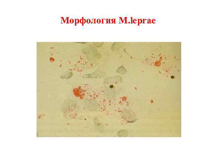 Морфология M. leprae 