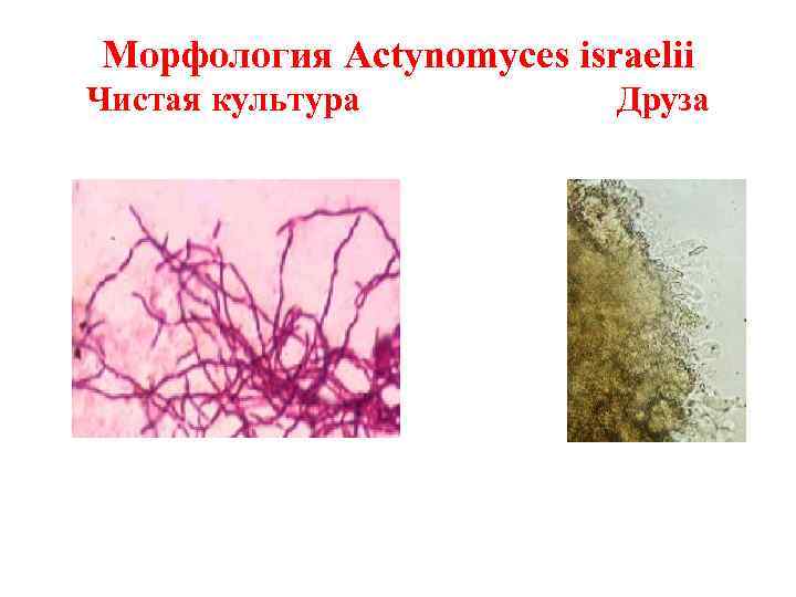 Строение микобактерии туберкулеза схема