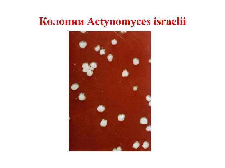 Колонии Actynomyces israelii 