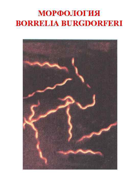 МОРФОЛОГИЯ BORRELIA BURGDORFERI 