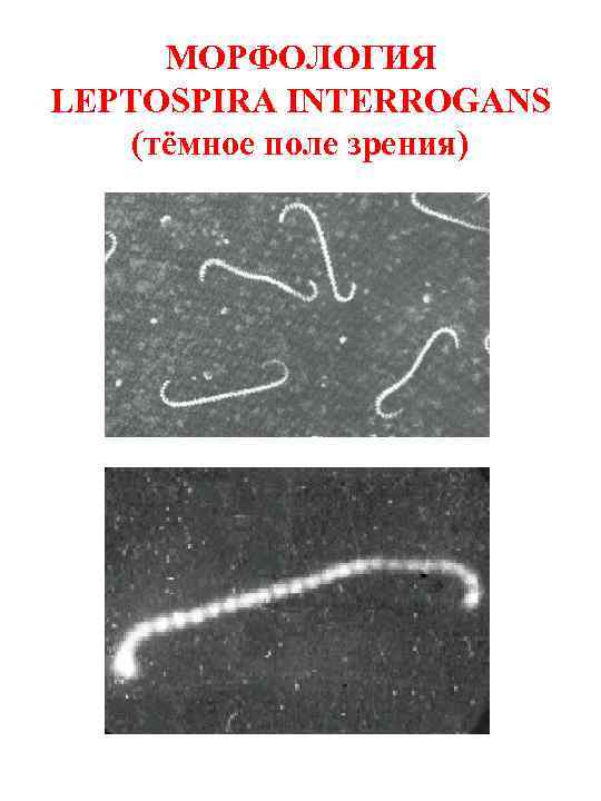 МОРФОЛОГИЯ LEPTOSPIRA INTERROGANS (тёмное поле зрения) 
