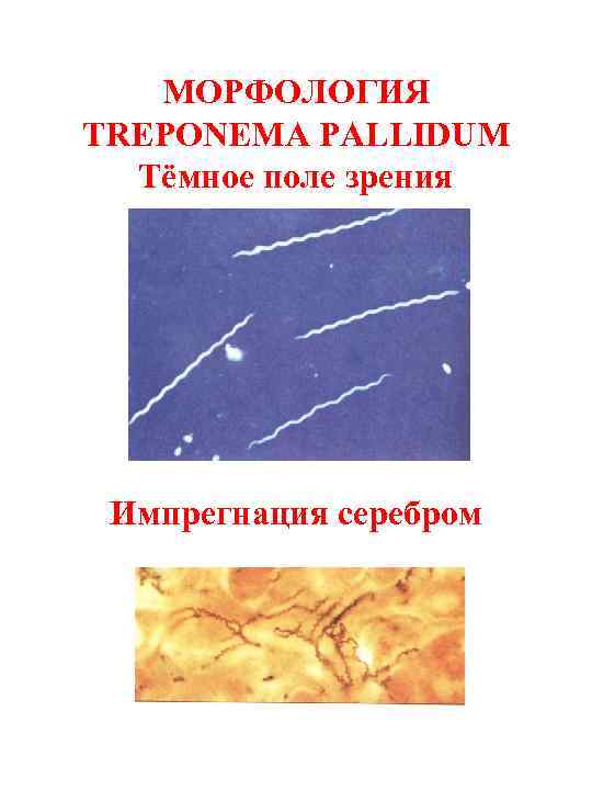 МОРФОЛОГИЯ TREPONEMA PALLIDUM Тёмное поле зрения Импрегнация серебром 