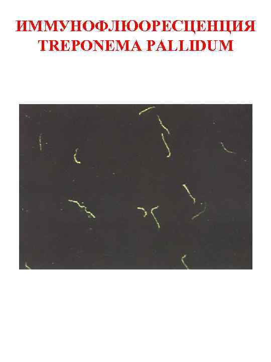ИММУНОФЛЮОРЕСЦЕНЦИЯ TREPONEMA PALLIDUM 