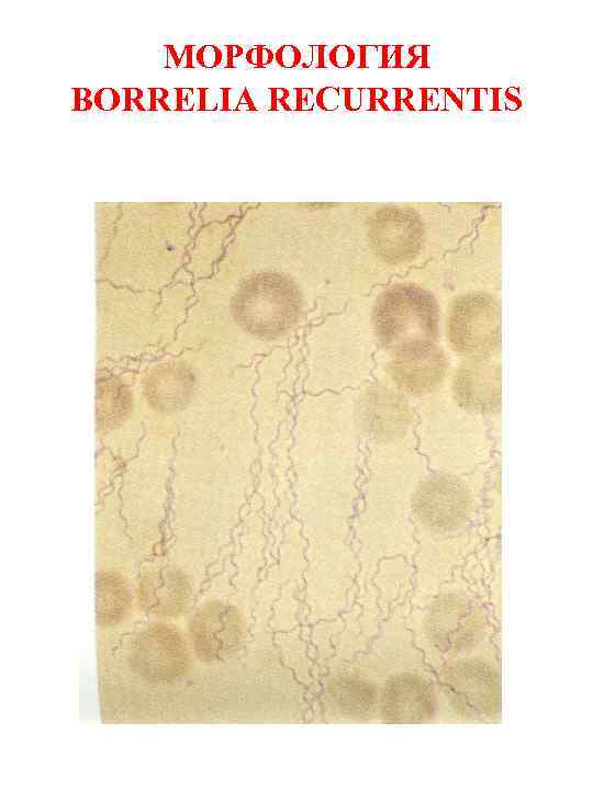МОРФОЛОГИЯ BORRELIA RECURRENTIS 
