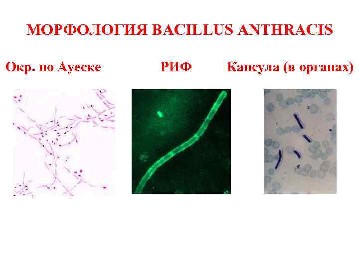 МОРФОЛОГИЯ BACILLUS ANTHRACIS Окр. по Ауеске РИФ Капсула (в органах) 