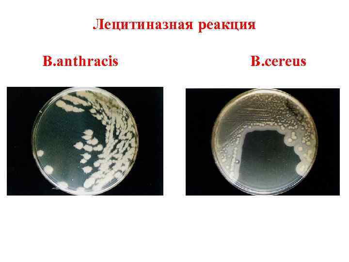 Лецитиназная реакция B. anthracis B. cereus 