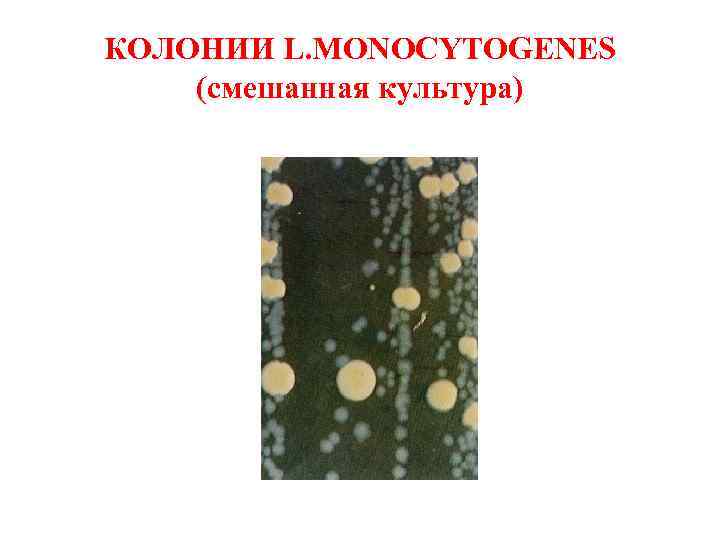 КОЛОНИИ L. MONOCYTOGENES (смешанная культура) 