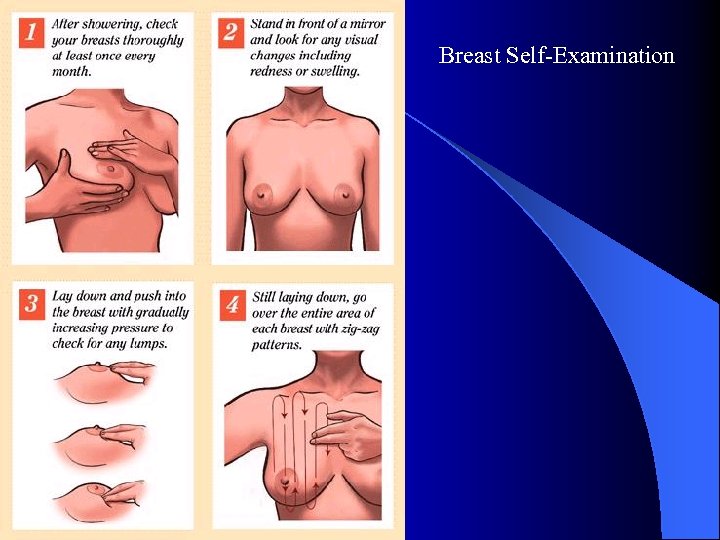 Breast Self Examination 