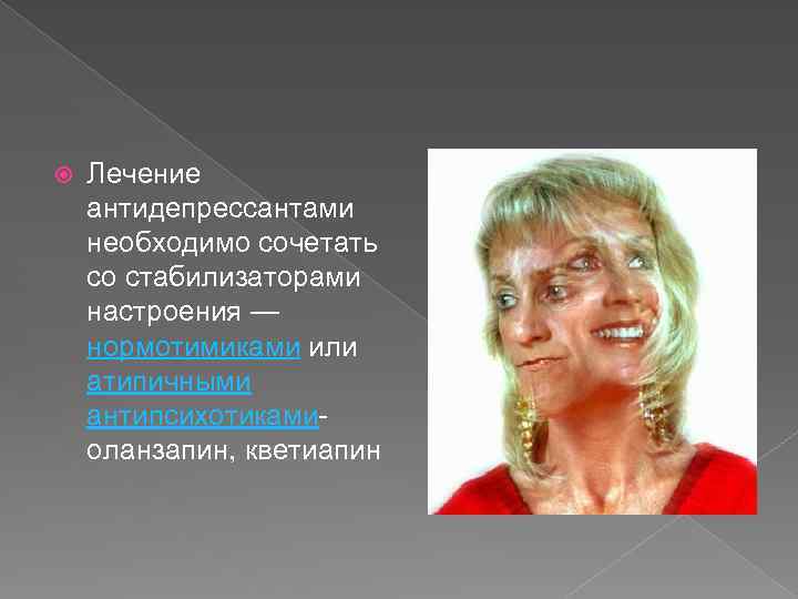  Лечение антидепрессантами необходимо сочетать со стабилизаторами настроения — нормотимиками или атипичными антипсихотиками оланзапин,