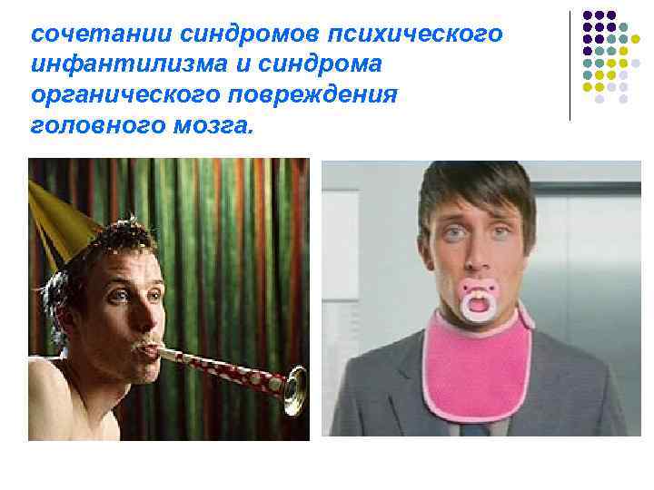 сочетании синдромов психического инфантилизма и синдрома органического повреждения головного мозга. 