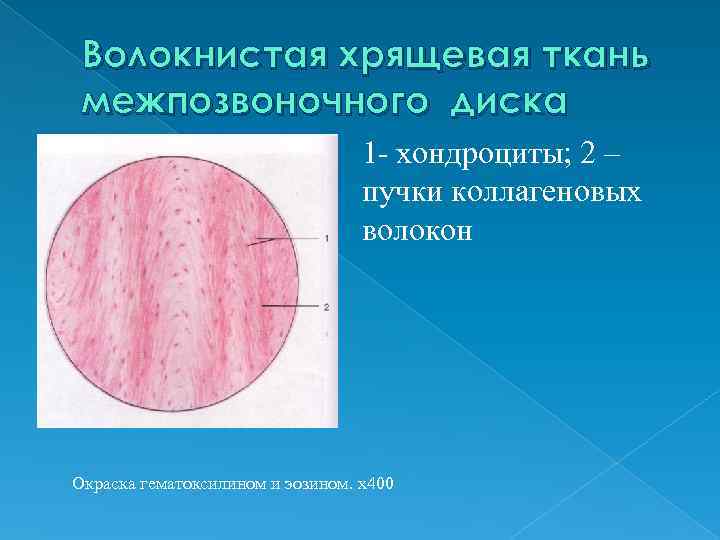 Волокнистая хрящевая ткань межпозвоночного диска 1 - хондроциты; 2 – пучки коллагеновых волокон Окраска