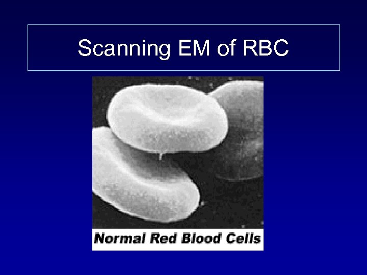 Scanning EM of RBC 