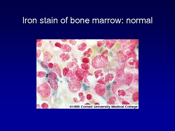 Iron stain of bone marrow: normal 