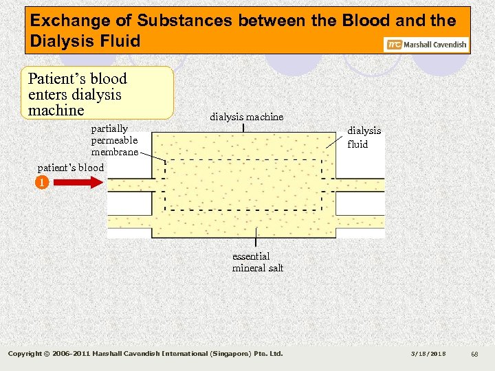 Exchange of Substances between the Blood and the Dialysis Fluid Patient’s blood enters dialysis