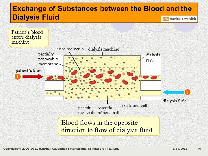 Exchange of Substances between the Blood and the Dialysis Fluid Patient’s blood enters dialysis