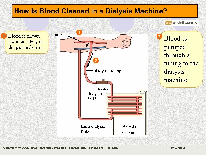 How Is Blood Cleaned in a Dialysis Machine? 1 Blood is drawn artery 1