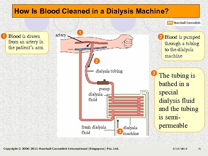 How Is Blood Cleaned in a Dialysis Machine? 1 Blood is drawn artery 1