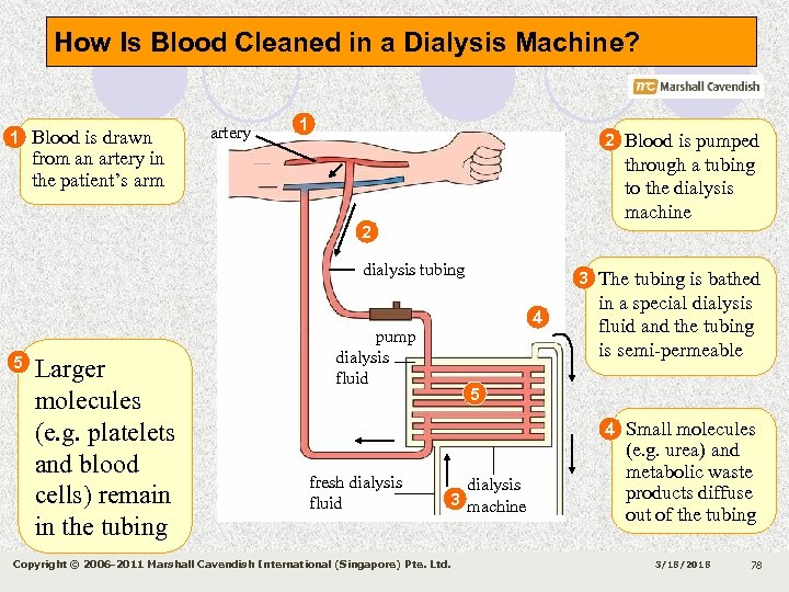How Is Blood Cleaned in a Dialysis Machine? 1 Blood is drawn artery 1