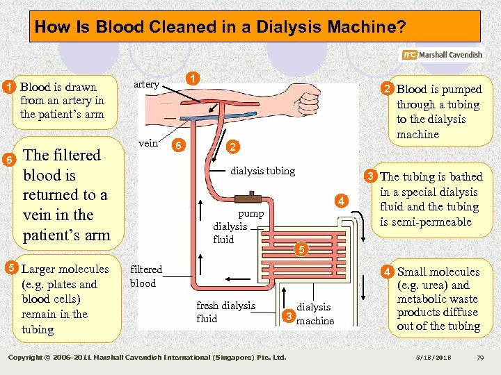 How Is Blood Cleaned in a Dialysis Machine? 1 Blood is drawn 1 artery