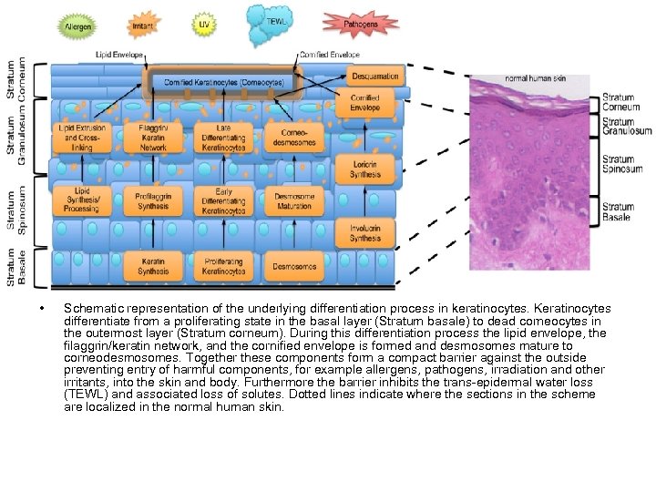  • Schematic representation of the underlying differentiation process in keratinocytes. Keratinocytes differentiate from