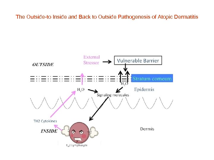 The Outside-to Inside and Back to Outside Pathogenesis of Atopic Dermatitis 