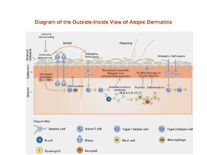 Diagram of the Outside-Inside View of Atopic Dermatitis 