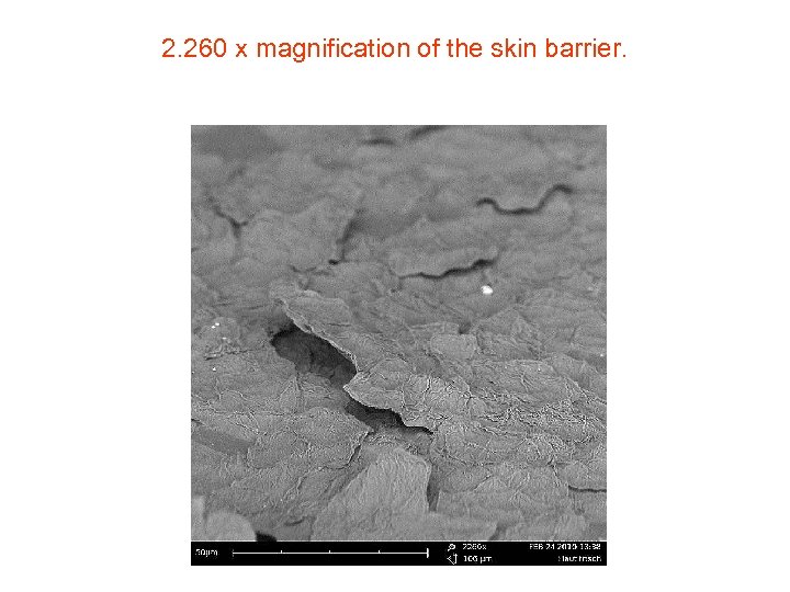 2. 260 x magnification of the skin barrier. 