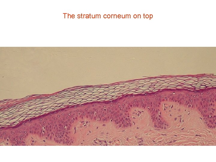 The stratum corneum on top 