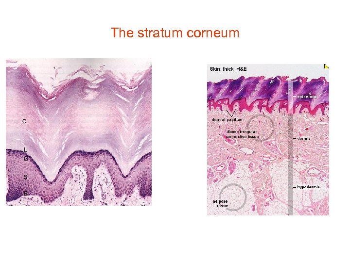 The stratum corneum 