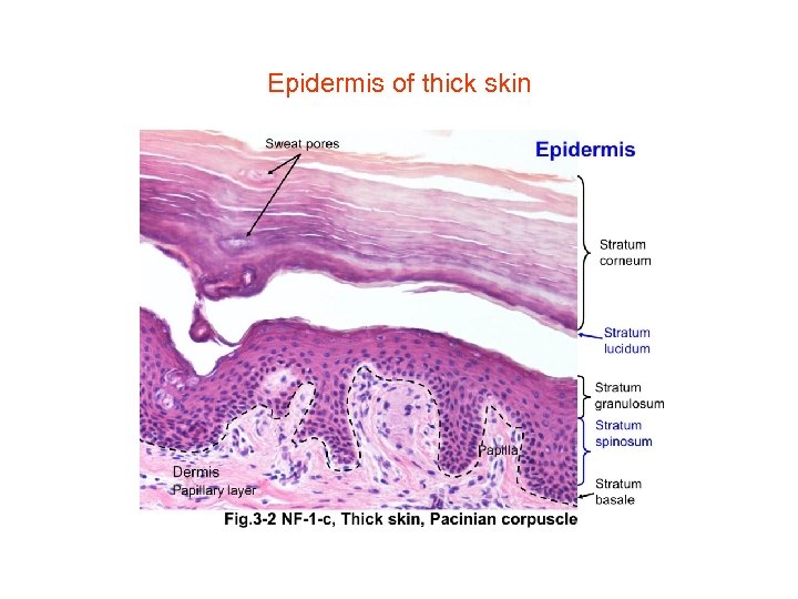Epidermis of thick skin 