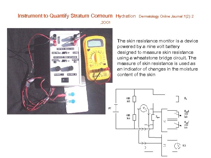  Instrument to Quantify Stratum Corneum Hydration Dermatology Online Journal 7(2): 2 , 2