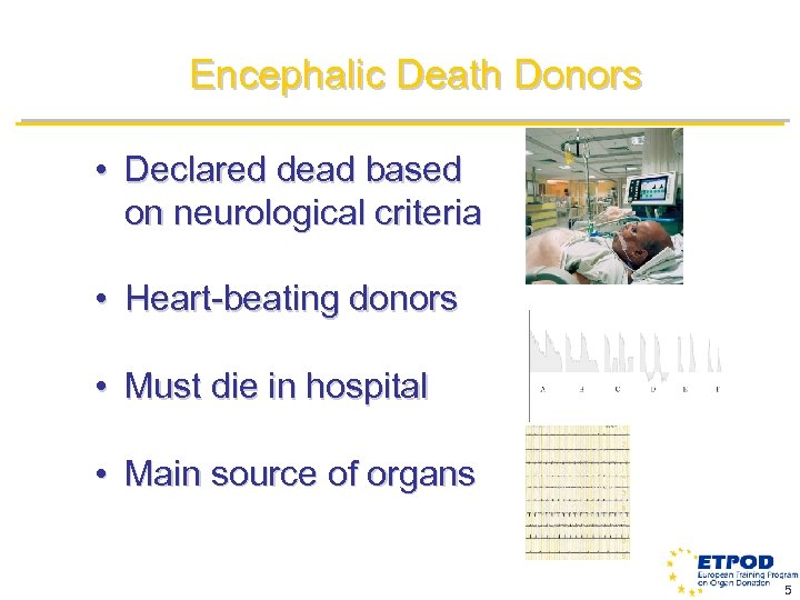 Encephalic Death Donors • Declared dead based on neurological criteria • Heart-beating donors •