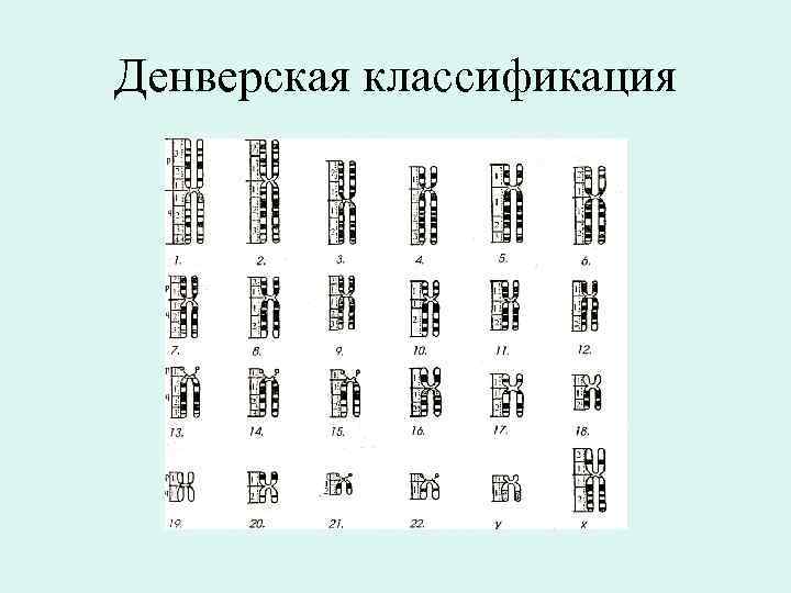 Денверская классификация 