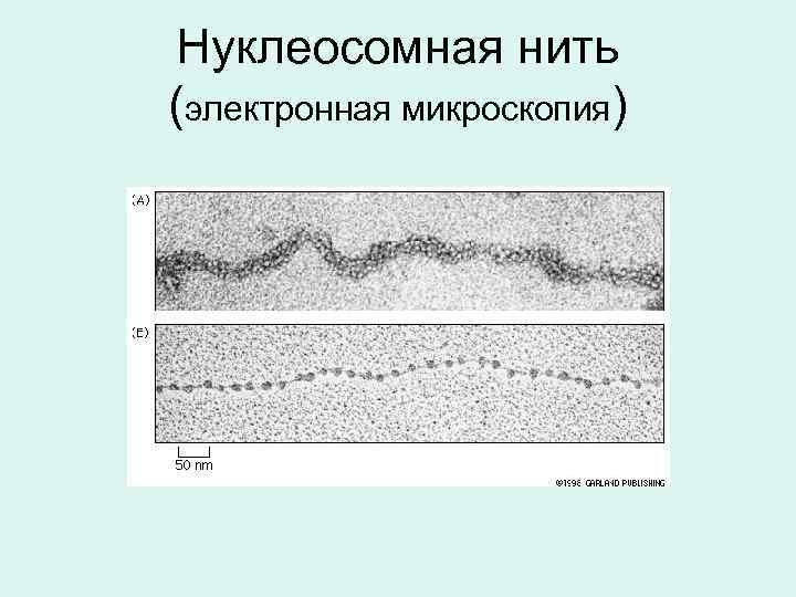 Нуклеосомная нить (электронная микроскопия) 