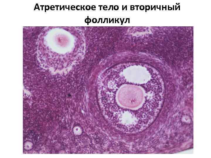 Строение женской половой системы рисунок