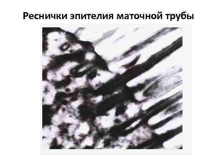 Реснички эпителия маточной трубы 